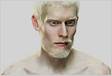 Um homem albino cujos pais tem pigmentação normal na pele casou-se